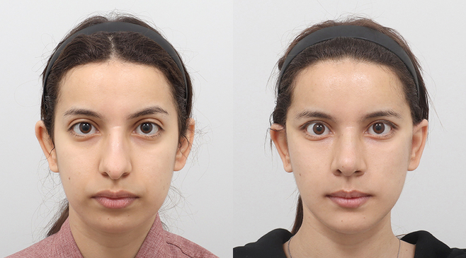 Slider image (3) AB Plastic Surgery